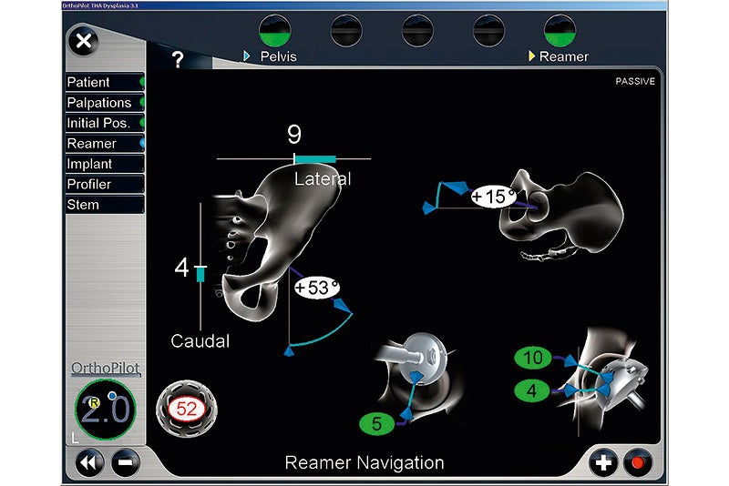 Reamer Navigation