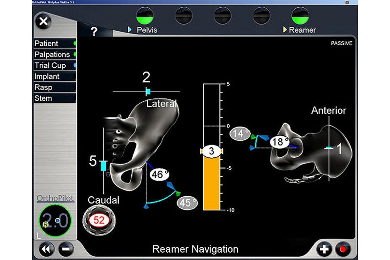 Reamer Navigation