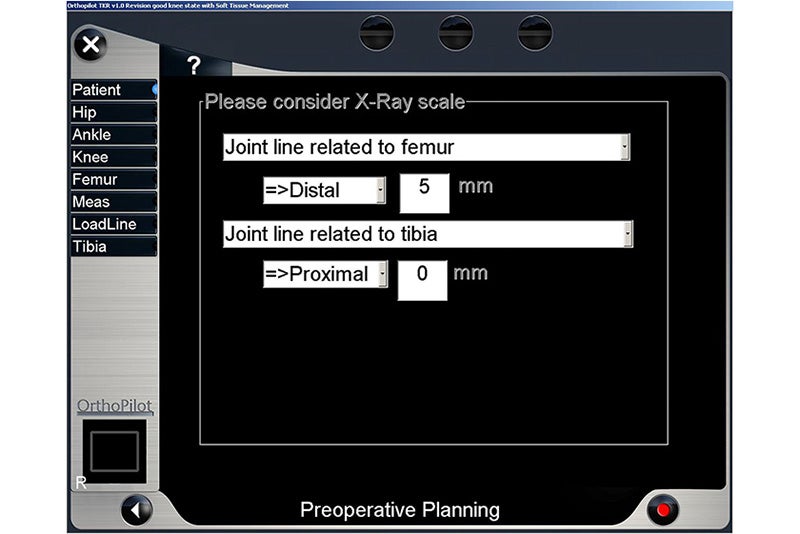 Preoperative Planning