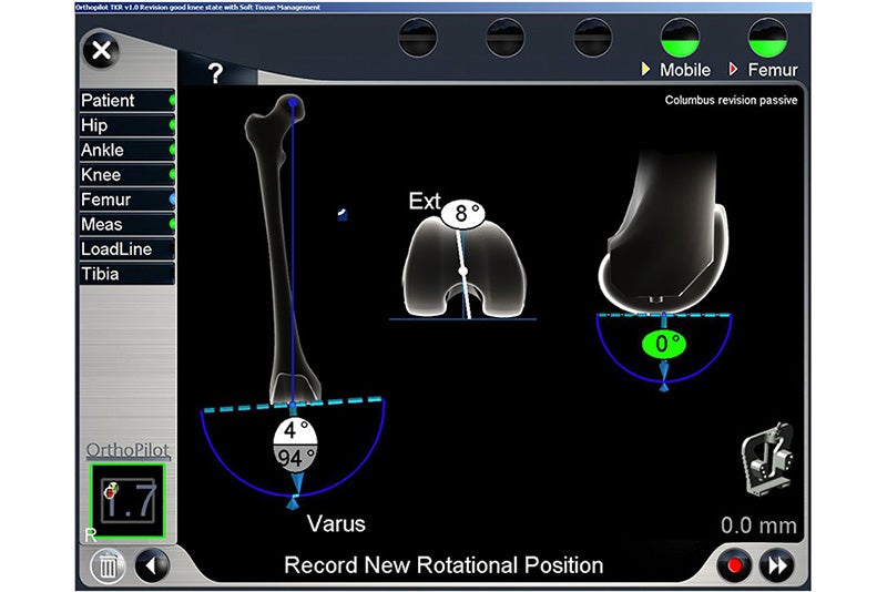 Record New Rotational Position