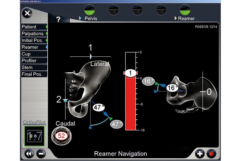 Reamer Navigation