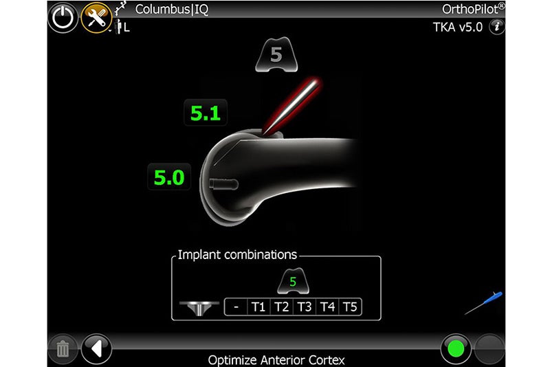 Optimize Anterior Cortex