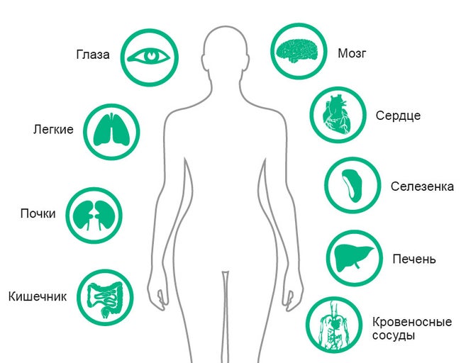 Parts and organs of the human body mainly affected by particulate contamination of IV fluids: Eye, Lung, Kidney, Intestine, Brain, Heart, Spleen, Liver, Blood Vessels.