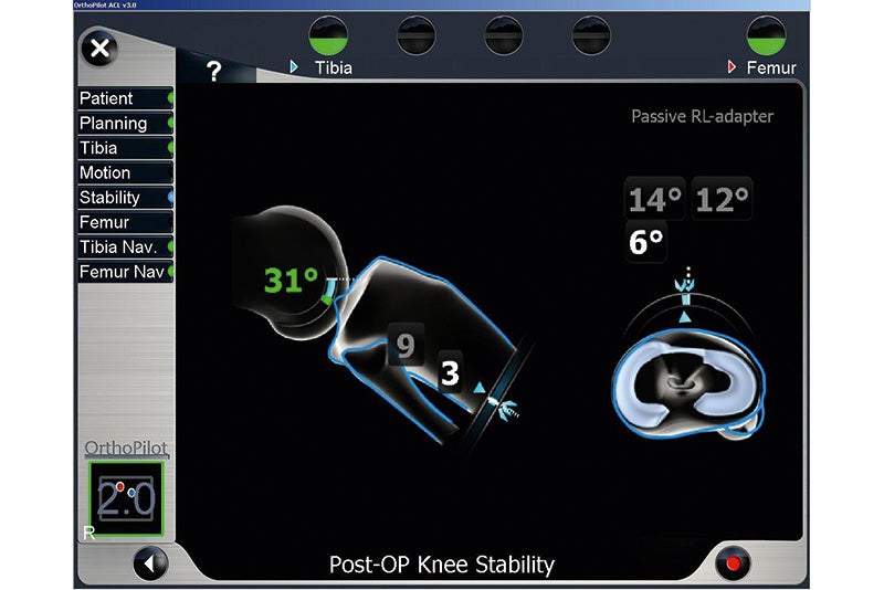 Post OP Knee Stability