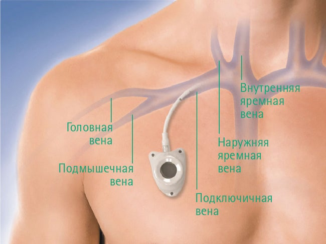 Celsite-Surecan