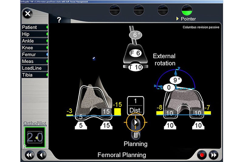 Femoral Planning